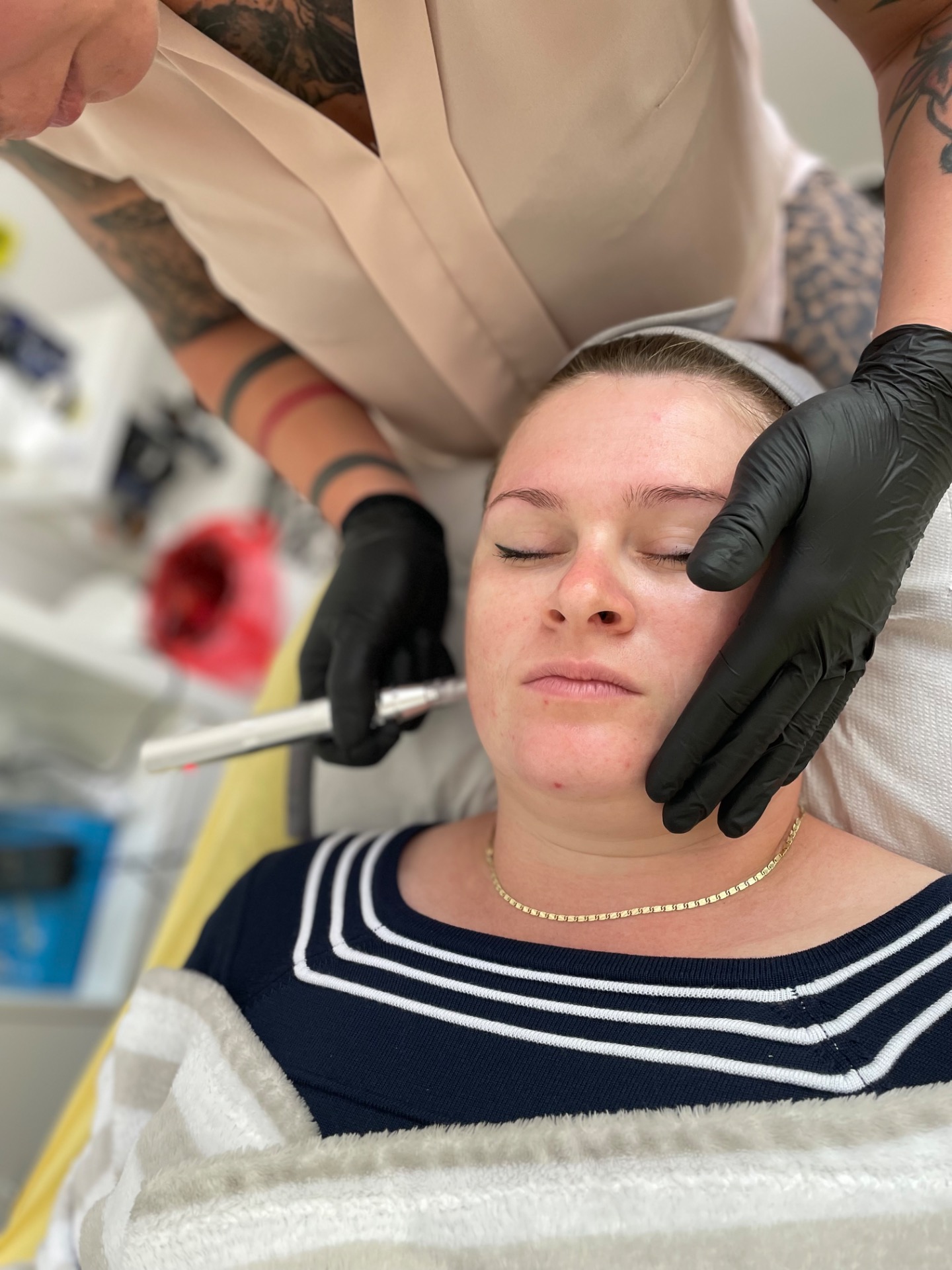 MIKROJEHLIČKOVÁNÍ